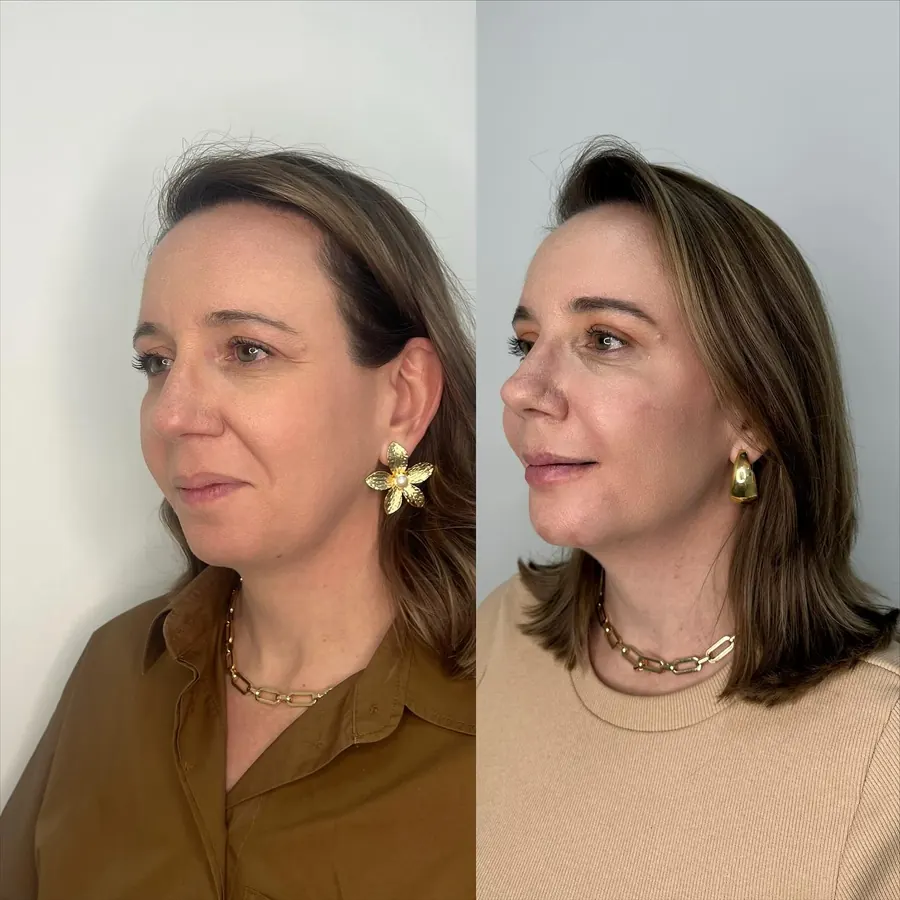 Full face sem grandes mudanças: antes à esquerda e depois à direita