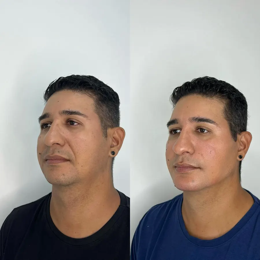 Bigode chinês e contorno: antes à esquerda e depois à direita